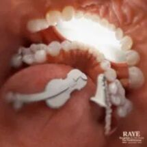 Escapism. (ft 070 Shake)